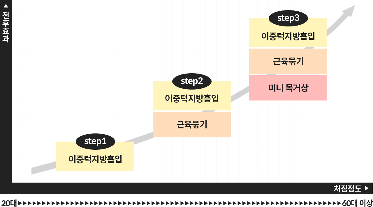 20대부터 60대 이상까지 처짐 정도에 따른 단계별 이중턱 수술 가이드. 1단계는 이중턱 지방흡입, 2단계는 지방흡입과 근육묶기, 3단계는 지방흡입, 근육묶기에 미니 목거상을 결합한 방식 제안